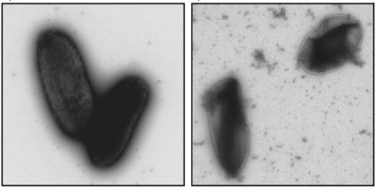 Electron microscopy photo of an Escherichia coli before and after using a Drigalski spatula.