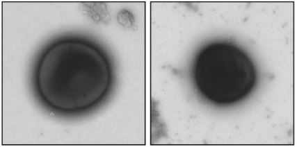 Electron microscope photo of a staphylococcus aureus before and after spreading with a rake.
