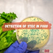 detection of STEC e.coli in food sample.
