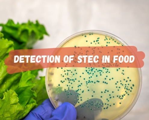detection of STEC e.coli in food sample.